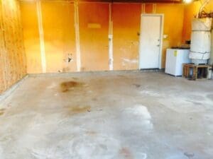 Dramatic-Transformation-Before